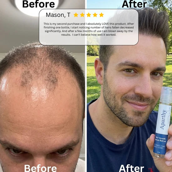 Advanced Hair Growth Roll-On Serum