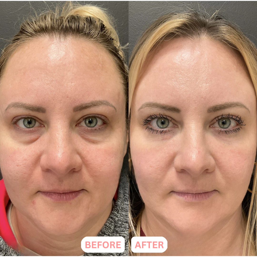 Lymphatic Contour Face Brush