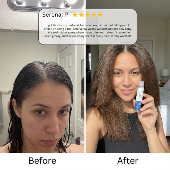 Advanced Hair Growth Roll-On Serum