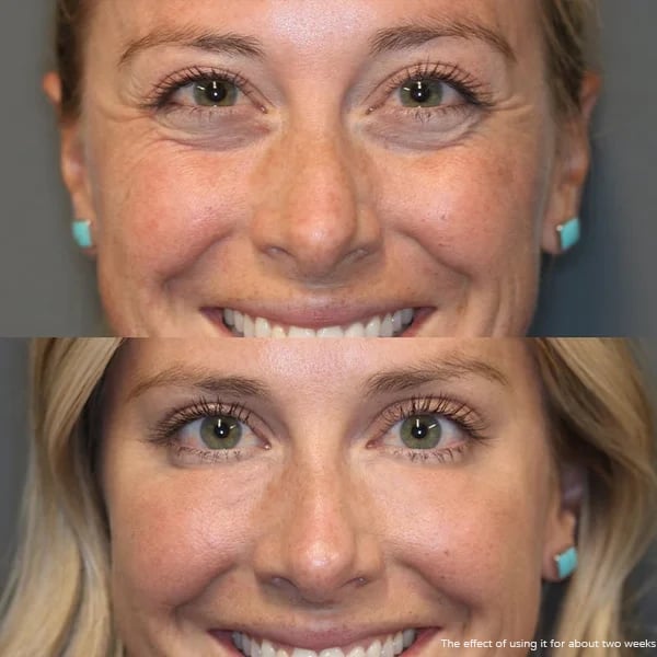 🥰2025 New Hot Sales - 50% OFF✨Luminous Eye Corrector SPF 45