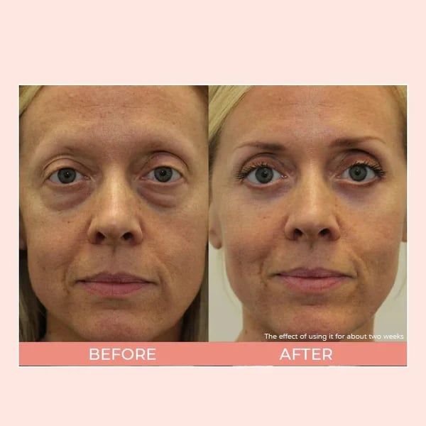 🥰2025 New Hot Sales - 50% OFF✨Luminous Eye Corrector SPF 45